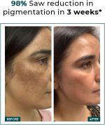 ⁦كونكوشس كيمست كريم وجه بحمض كوجيك | 50 غرام | كريم حمض الازيليك للرجال والنساء، النياسيناميد وحمض الترانيكساميك، مضاد للتصبغ، يقلل البقع الداكنة، لجميع انواع البشرة - تروبيوم⁩ - الصورة ⁦2⁩