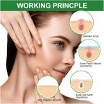 ⁦سكاي-تاتش رقعة بثرة حب الشباب - 36 قطعة من ملصقات البقع الغروانية المائية للوجه والجسم، غطاء عيوب غير مرئي ومقاوم للماء، مقاسين لزيتس، للعناية بالبشرة خالية من الزيوت لجميع انواع البشرة⁩ - الصورة ⁦3⁩