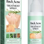 بخاخ لعلاج حب الشباب من لبوي لوف - 2% من حمض الساليسيليك وحمض هيبوكلوروس لعلاج حب الشباب في الجسم، 120 مل - تنظيف عميق، يتلاشى الندوب، اصلاح مهدئ للظهر والصدر والكتفين