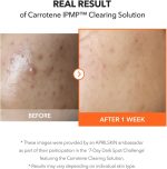 ⁦محلول التنظيف كاروتين IPMP™ من أبريلسكين | نباتي بالكامل وصُنع بدون إساءة تجاه الحيوانات | لا يسبب انسداد المسامات⁩ - الصورة ⁦5⁩