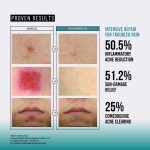 ⁦جوميسو سنيل موسين 95% + ببتيد ايسنس 4.73 اونصة سائلة/140 مل | سيروم مرطب مع حلزون، مرطب للوجه للبشرة الجافة، ترطيب يومي عميق، العناية بالبشرة الكورية⁩ - الصورة ⁦3⁩