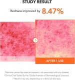 ⁦محلول التنظيف كاروتين IPMP™ من أبريلسكين | نباتي بالكامل وصُنع بدون إساءة تجاه الحيوانات | لا يسبب انسداد المسامات⁩ - الصورة ⁦6⁩