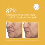 ⁦ناتشورال حمض موضعي 5% من ترانيكساميك⁩ - الصورة ⁦5⁩