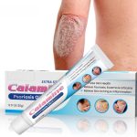 نوفولان مرهم الصدفية، 20 غرام - كريم تخفيف الصدفية، علاج فعال لحكة البشرة الجافة، مرهم مهدئ للاكزيما والتهاب الجلد، يدعم اصلاح الجلد لفروة الرأس واليدين والقدمين