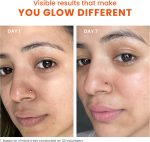⁦Foxtale SPF 70 Niacinamide Dewy Sunscreen with PA++++ For Dewy Sun Protection|Prevents Tan|Lightenweight, Non Greasy, No White Cast|Anti-Tan Formula|For Men & Women|For all skin type,50 Ml⁩ - الصورة ⁦5⁩
