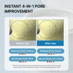 ⁦نيدلي وسادات تقشير الوجه مع بي اتش ايه وبي اتش ايه⁩ - الصورة ⁦4⁩