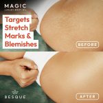 ⁦زيت الجسم ماجيك من بيسك، 3.38 اونصة سائلة، زيت الجسم بعد الاستحمام للنساء، مرطب للعناية بالبشرة لكامل الجسم الذي يملأ البشرة ويشدها ويثبتها بمكونات طبيعية، هدايا سبا فاخرة - عبوة من قطعة واحدة⁩ - الصورة ⁦4⁩