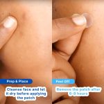 ⁦سوترو رقعة بثرة حب الشباب | رقع غروانية مائية مقاومة للماء | لحب الشباب السطحي النشط | تمتص البثور طوال الليل وتقلل من الزيت الزائد | لجميع انواع البشرة⁩ - الصورة ⁦8⁩