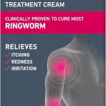 كريم مضاد للفطريات من السعفة من لوتريمين، 0.42 اونصة