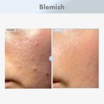 ⁦توسوونج مصل وجه 15% من نياسيناميد، 150,100 جزء في المليون نياسيناميد، حمض الترانيكساميد، يدعم لون البشرة المتساوية، البشرة الزجاجية، بشرة مشعة، يحسن مظهر المسام، العناية بالبشرة الكورية، 30 مل، 1.01⁩ - الصورة ⁦2⁩