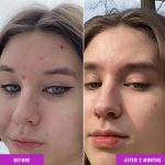 ⁦جوود موليكيولز سيروم نياسيناميد⁩ - الصورة ⁦4⁩