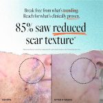 ⁦Derma E Scar Gel -2oz (56 g)⁩ - الصورة ⁦3⁩