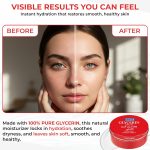 ⁦كريم الغليسرين النقي من اس زد ستار 250 غرام - كريم مرطب عميق وتنعيم البشرة للوجه والجسم - للبشرة الجافة والخشنة والحساسة - يرطب ويهدئ ويعيد إشراقة البشرة⁩ - الصورة ⁦5⁩