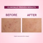 ⁦Pond's Bright Beauty Anti-Spot Serum Cream with Niacinamide and SPF 15 PA++ Fades Dark Spots and Reveals Bright Skin, 50g⁩ - الصورة ⁦4⁩