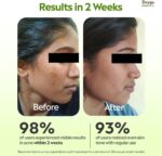 ⁦جل الصبار من ديجا | نقي وعضوي متعدد الاغراض | شفاف غير لاصق للوجه والبشرة والشعر | يهدئ حب الشباب والبقع الداكنة وحروق الشمس | للرجال والنساء | لجميع انواع البشرة (100 غرام)⁩ - الصورة ⁦2⁩