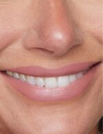 ⁦ريفي ليب سكلبت (فاون)، 0.1 اونصة⁩ - الصورة ⁦3⁩