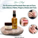 ⁦اوليومك كوتيج حزمة العناية بالبشرة للرقع الصغيرة على الجسم للاكزيما والصدفية والتهاب الجلد | تحتوي على زيت ترميم وكريم علاجي فائق | يقلل من الحكة ويهدئ التوهج⁩ - الصورة ⁦2⁩