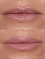 ⁦ريفي ليب سكلبت (فاون)، 0.1 اونصة⁩ - الصورة ⁦5⁩