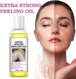 ⁦زيت تقشير اصفر للبشرة الداكنة من مهيبزول، زيت اصفر مقشر للحصول على حل تقشير فائق القوة لتفتيح البشرة، زيوت تقشير صفراء مع هيالورونات الصوديوم الساليسيليك⁩ - الصورة ⁦3⁩