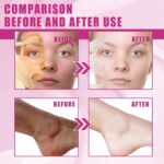 ⁦زيت تقشير اصفر للبشرة الداكنة من مهيبزول، زيت اصفر مقشر للحصول على حل تقشير فائق القوة لتفتيح البشرة، زيوت تقشير صفراء مع هيالورونات الصوديوم الساليسيليك⁩ - الصورة ⁦5⁩