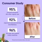 ⁦ارافي اورجانيك لوشن للجسم 10% ايه اتش ايه + 1% بي اتش ايه للتقشير - يعالج ساقين الفراولة والبشرة المتوترة بالسيراميد - لوشن لتفتيح البشرة بالنياسيناميد وزبدة الشيا - 200 مل⁩ - الصورة ⁦5⁩