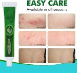 ⁦كريم مضاد للفطريات، كريم مضاد للحكة بمكونات عشبية اكثر لطفًا وامانًا، يعيد الحكة بسرعة للوجه والجسم ويساعد على اكزيما والسعفة وحكة الجوك والالتهابات الفطرية للقدم والاظافر⁩ - الصورة ⁦5⁩