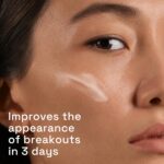 ⁦سيتافيل مصل علاج حب الشباب ثلاثي المفعول مع حمض الساليسيليك، يعالج ويمنع حب الشباب، رائع لعلامات ما بعد حب الشباب، لجميع انواع البشرة، 1 اونصة⁩ - الصورة ⁦5⁩