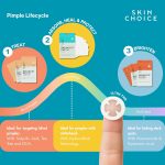 ⁦رقع سبوت باتشز من سكين تشويس - رقع حب الشباب (عبوة من 30 قطعة) رقع غروانية مائية، ملصقات بقعة بثرة، معالجة بقع العيوب، نقاط قوية للبقع، نباتي، لم يتم اختباره على الحيوانات، للعناية بالوجه والبشرة⁩ - الصورة ⁦9⁩