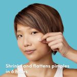 ⁦رقع سبوت باتشز من سكين تشويس - رقع حب الشباب (عبوة من 30 قطعة) رقع غروانية مائية، ملصقات بقعة بثرة، معالجة بقع العيوب، نقاط قوية للبقع، نباتي، لم يتم اختباره على الحيوانات، للعناية بالوجه والبشرة⁩ - الصورة ⁦2⁩