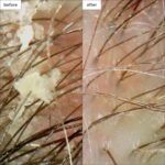 ⁦بريوجيو شامبو تقشير دقيق بالفحم وزيت جوز الهند من سكالب ريفايفل، 8 اونصة⁩ - الصورة ⁦4⁩