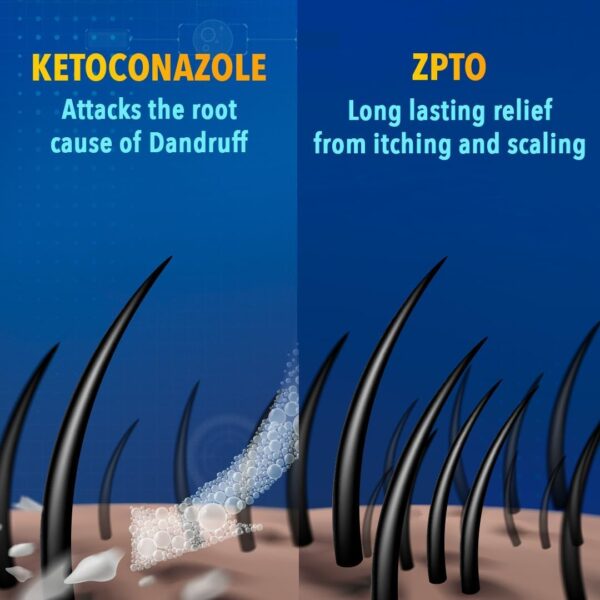 شامبو باسيكالي إكسبيرت المضاد للقشرة (75 مل) - عبوة من قطعتين