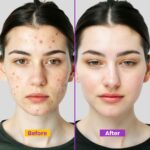 ⁦BIOCOS كريم مضاد للعلامات (عبوة من قطعتين) مزيل للبقع الداكنة وعلاج لحب الشباب مع النياسيناميد والكولاجين - تفتيح وترطيب للبشرة اللامعة - حماية من الأشعة فوق البنفسجية - 16 جرام⁩ - الصورة ⁦2⁩