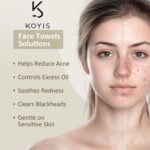 ⁦مناديل وجه قابلة للاستعمال مرة واحدة من كويس - مناديل مبللة قابلة للتحلل البيولوجي لجفاف البشرة الحساسة، مناشف وجه قطنية طويلة الألياف للعناية بالوجه وإزالة المكياج، مع غطاء مغناطيسي مقاوم للغبار⁩ - الصورة ⁦6⁩