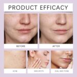 ⁦كريم حمض الأزيليك 14%، كريم حب الشباب، يخفف الاحمرار للوجه، كريم العناية بالبشرة لتقليل الاحمرار، كريم حمض الأزيليك الممتاز، يمنع ظهور حب الشباب، العناية بجمال البشرة والوجه⁩ - الصورة ⁦4⁩