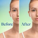 ⁦ديفيرين غسول وجه لحب الشباب مع 10% بنزويل بيروكسيد، منظف رغوي لحب الشباب فائق القوة بدون وصفة طبية، علاج حب الشباب سريع المفعول للوجه والجسم، 5 اونصة⁩ - الصورة ⁦6⁩