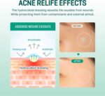 ⁦سوم من مي 30 دايز ميراكل كلير سبوت باتش - عبوة من 5 قطع، 90 قطعة، مقاسين (10 ملم 45 قطعة، 12 ملم 45 قطعة) - رقعة غير مرئية للبشرة الغروانية المائية والبثور بدون تهيج - للعناية بالبشرة الكورية⁩ - الصورة ⁦5⁩