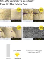 ⁦celimax The Vita A Retinal Shot Tightening Booster Duo Set 15mlx2 | Holiday Gift Set, Stocking Stuffers for Women | with Retinal 0.1%, Matryxyl 3%, Pore Minimizer, Wrinkles & Fine Lines, Firmer Skin⁩ - الصورة ⁦4⁩