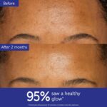 ⁦كاديلي مرطب فوري لتفتيح البقع الداكنة بالنياسيناميد من فينوبيرفيكت - 1.7 اونصة سائلة، قد تختلف العبوة⁩ - الصورة ⁦3⁩