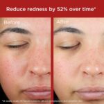 ⁦واقي شمس للوجه من التاماد لتجديد البشرة مع اكسيد الزنك، معدني بالكامل، آمن للبشرة الحساسة بعامل حماية من الشمس 50⁩ - الصورة ⁦4⁩